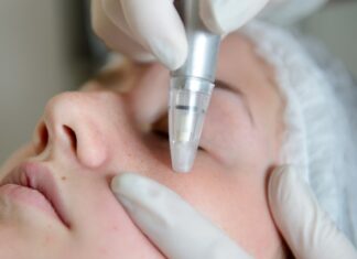 Na czym polega zabieg mikrodermabrazji?